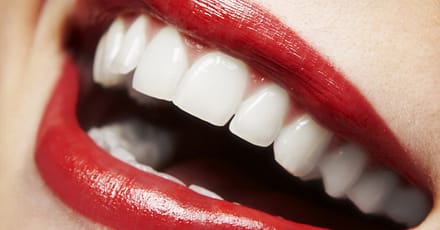 Dental Check-Up With Optional Stain Removal, Or Laser Teeth Whitening Dubai TMLH.com Special Offers, Deals & Discounts in Turkey