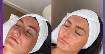 Facial – Anti-Ageing Dubai TMLH.com Special Offers, Deals & Discounts in Turkey
