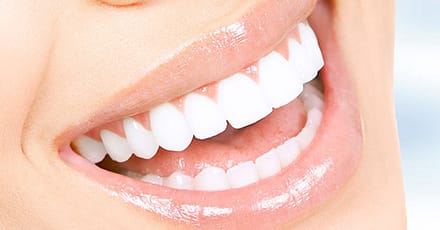 Scaling And Polishing With X-Ray At Omar Yahia Dental Surgery Clinic Dubai TMLH.com Special Offers, Deals & Discounts in Turkey