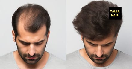 Extensions / Feathering Dubai TMLH.com Special Offers, Deals & Discounts in Turkey